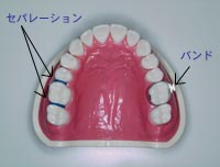 歯科矯正学 歯科矯正学 Root ZX3 | MORITA
